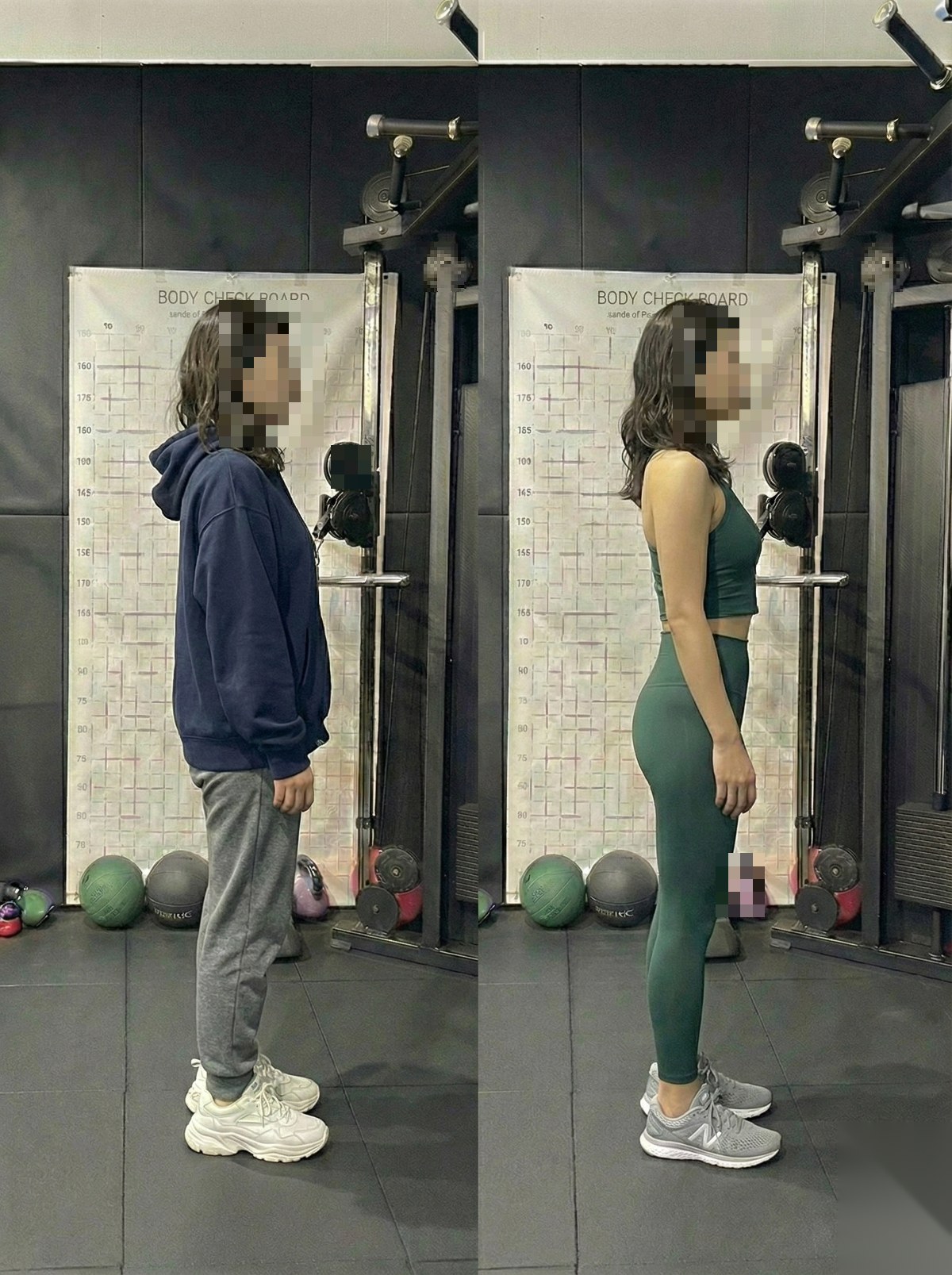 회원 전후 측면 비교 사진 (얼굴 모자이크)