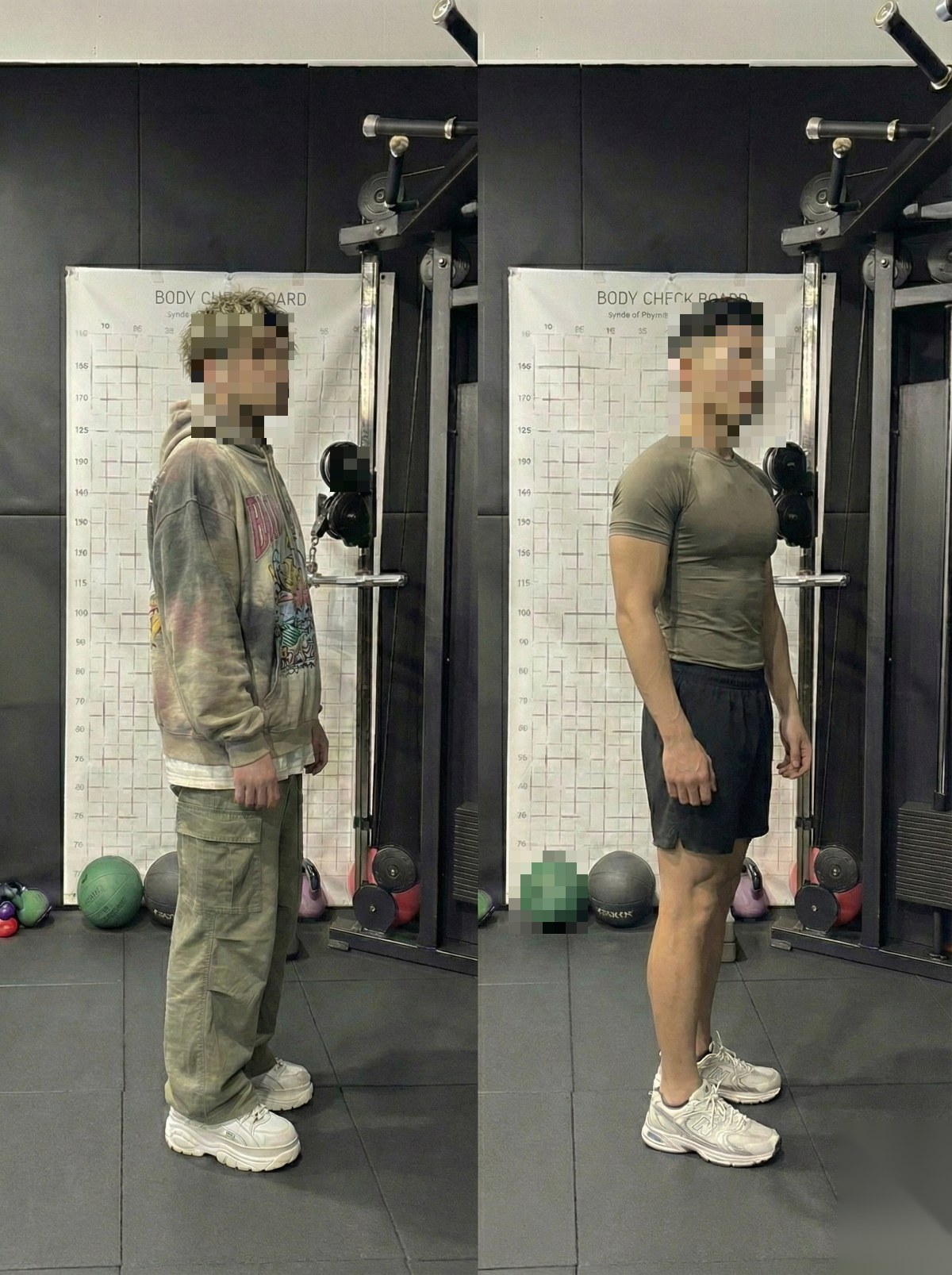 회원 전후 측면 비교 사진 (얼굴 모자이크)