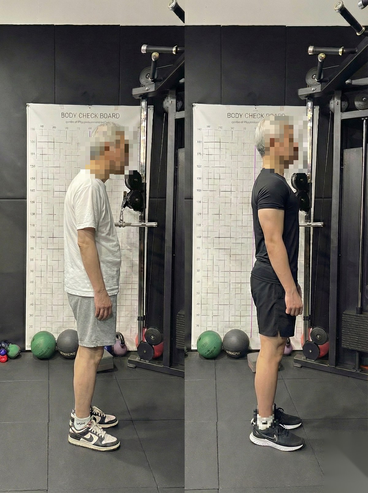 회원 비포·애프터 13
